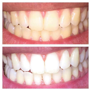 Insta Glow Sunless Tanner & Whitening Toothpaste - Save $23