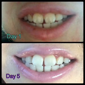 AP24 Whitening Toothpaste - SEE SPECIALS TO SAVE