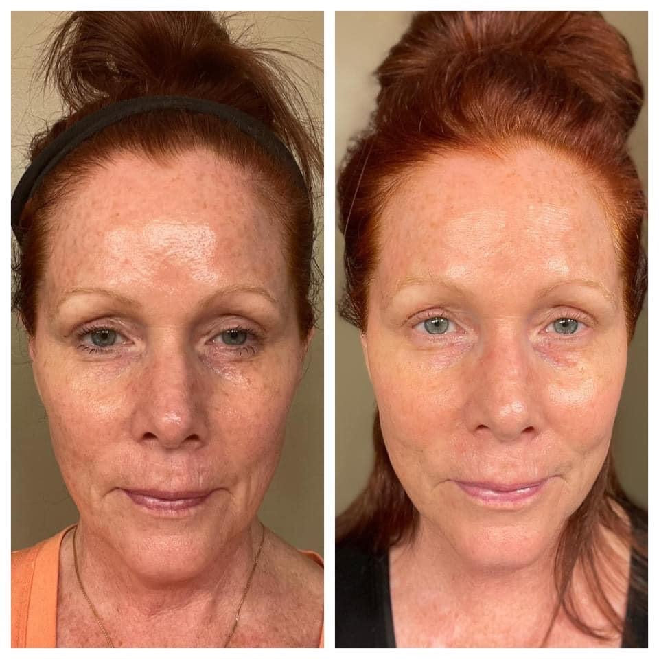 Collagen shop for skin