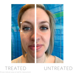 LumiSpa Accent with Ideal Eyes!